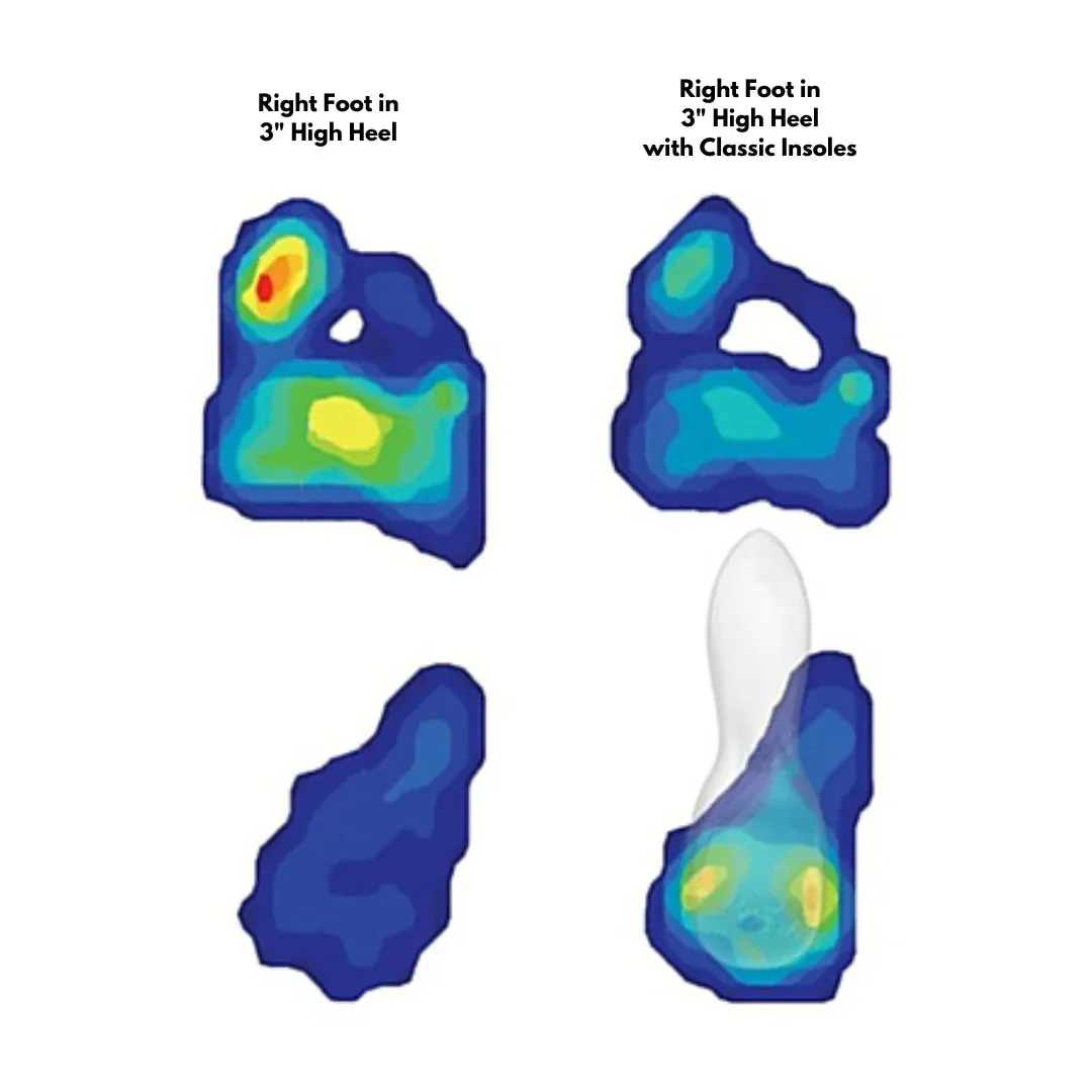 Classic Weight-Shifting Insoles for High Heels